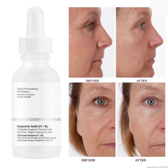 Hydrating Acid Private Label Private Label Skincare Serum Face Serum Skin Care Removing Dark Spots,Vitamin C Niacinamide Serum