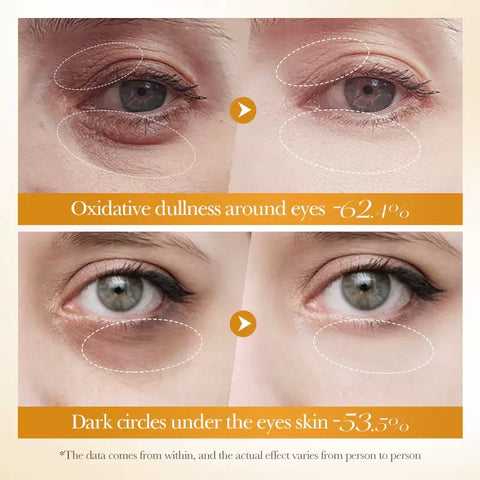 OEM Wholesale Custom Skin Care Dark Circle Anti Wrinkle Anti Aging Removal Eye Cream