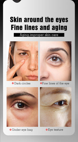 OEM Wholesale Custom Skin Care Dark Circle Anti Wrinkle Anti Aging Removal Eye Cream